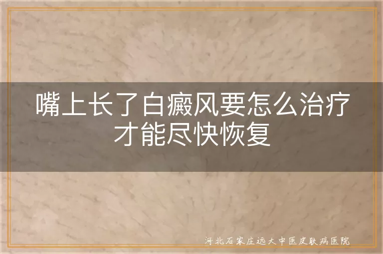 嘴上长了白癜风要怎么治疗才能尽快恢复