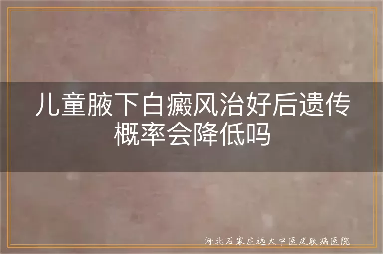 儿童腋下白癜风治好后遗传概率会变小吗,孩子腋下白斑治好了还会遗传给下一代吗,儿童腋下白癜风康复后遗传风险能降低吗