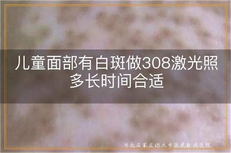 儿童面部白斑308激光照射时长,儿童脸上长白斑照308激光多久合适,白癜风孩子面部308照射时间多长