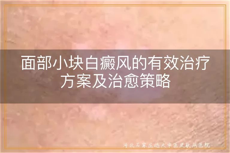 面部小块白癜风的有效治疗方案及治愈策略