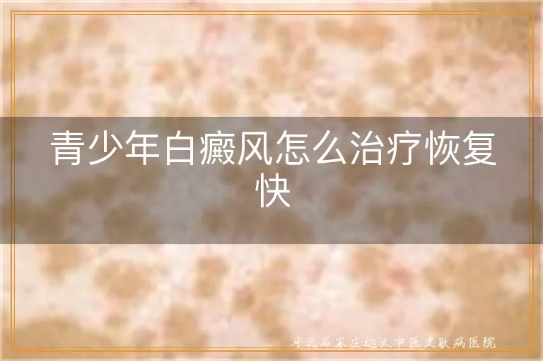 青少年白癜风怎么治疗恢复快