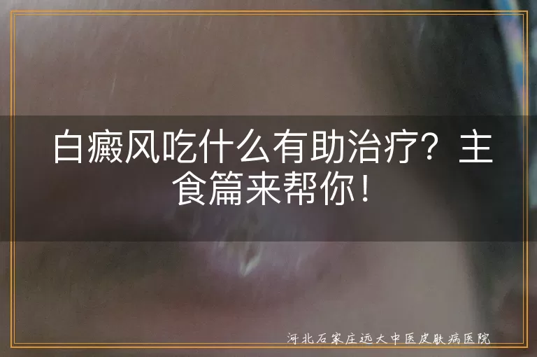 白癜风,主食,全谷物,薯类,豆类,辅助治疗