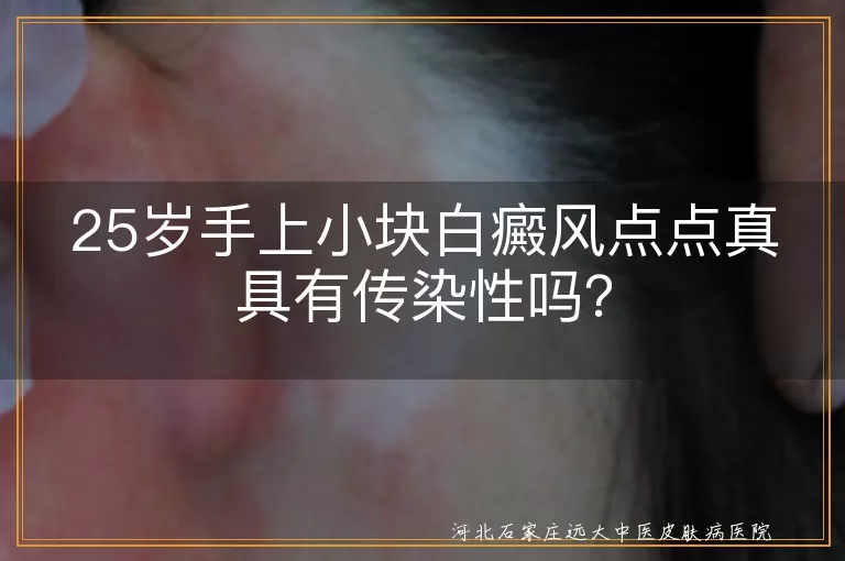 白癜风,传染性,病原体,治疗,日常生活,心态,防晒,健康生活方式
