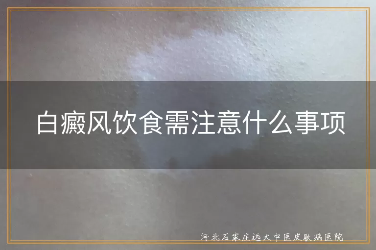 白癜风,饮食,营养,刺激性食物,饮食卫生,习惯,个人调整,积极心态