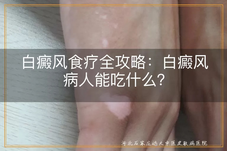 白癜风,食疗,酪氨酸,矿物质,维生素B族,黑色食物,营养均衡,辅助治疗