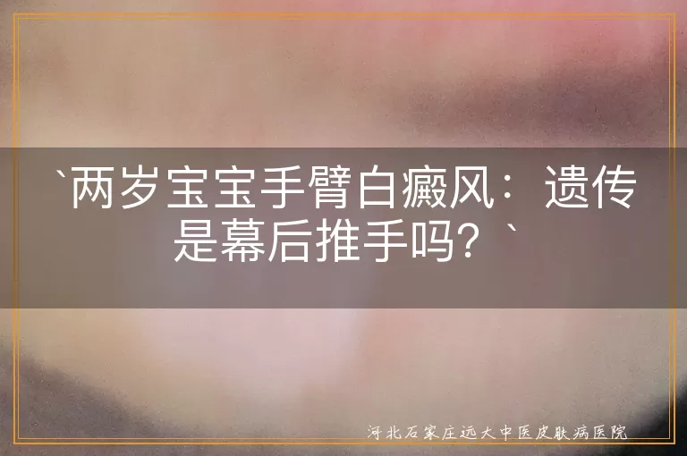 白癜风,遗传,儿童,治疗,预防,防晒,均衡饮食,心理健康