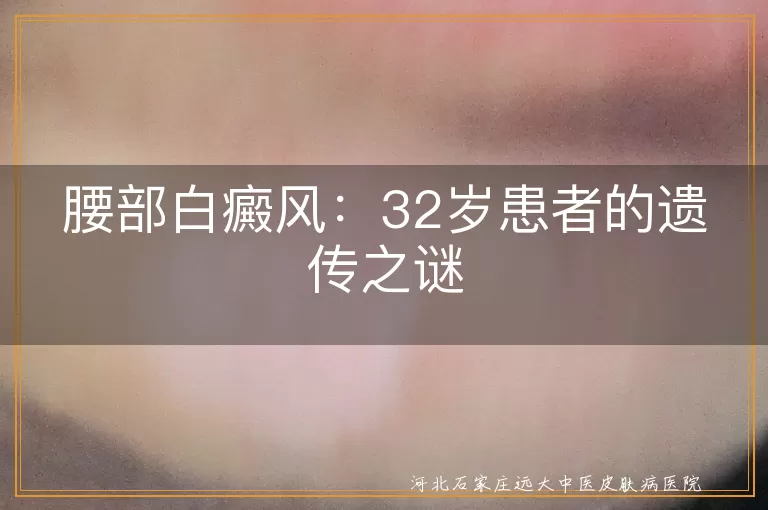 白癜风,遗传,自身免疫,精神因素,皮肤损伤,生活习惯,治疗