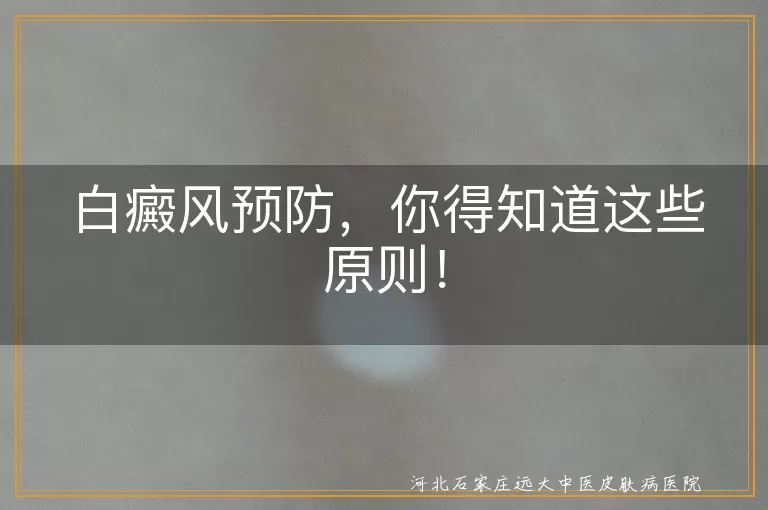 白癜风预防,生活习惯,防晒措施,心态调整,定期检查