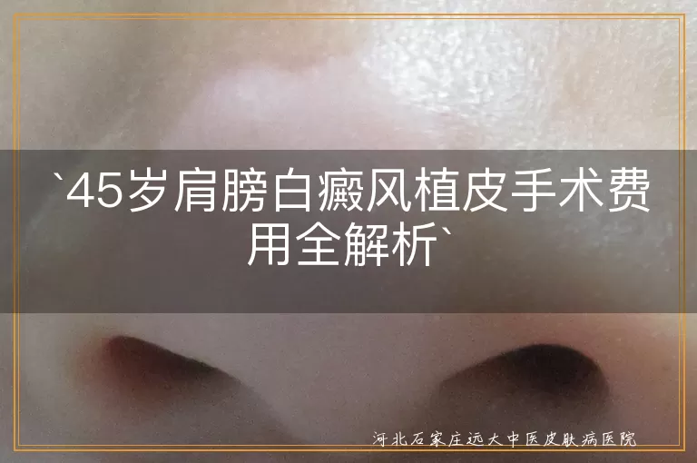 白癜风,植皮手术,费用,白斑面积,手术难度,恢复时间