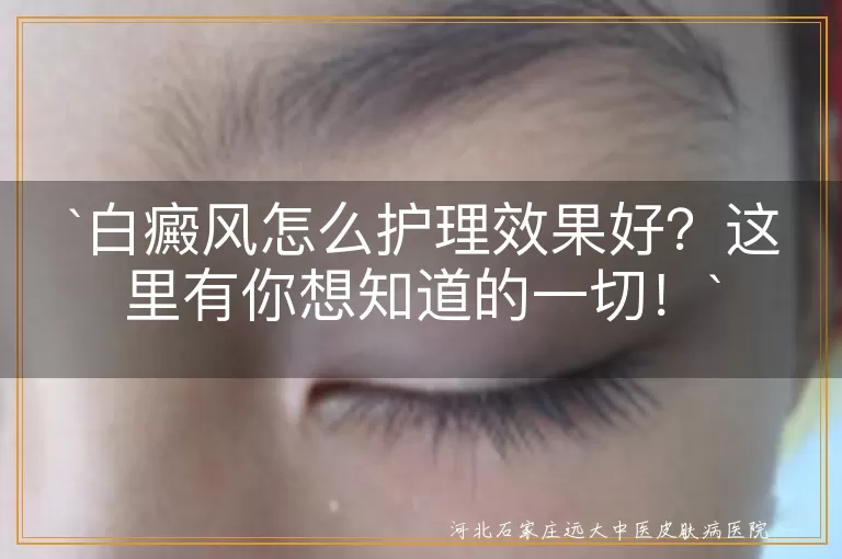 `白癜风,护理,皮肤清洁,保湿,防晒,合理饮食,补充营养,心理调适,压力管理,定期就医`