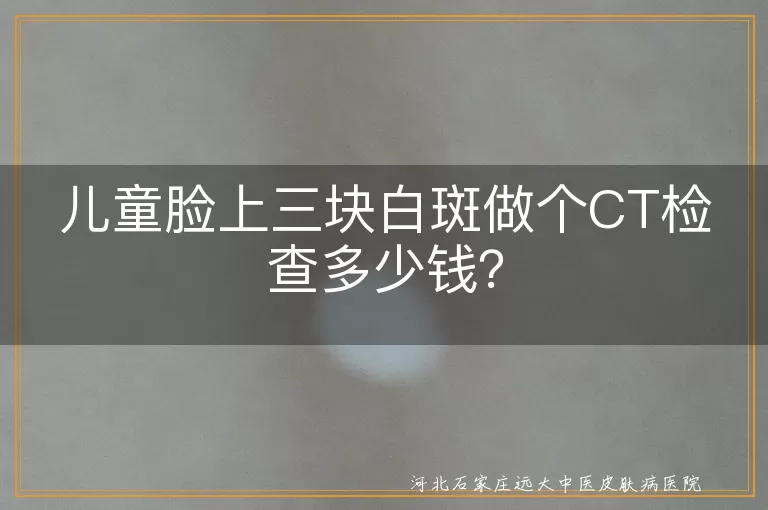 儿童白斑,CT检查,费用,医院等级,地区差异,检查仪器先进性,病情诊断