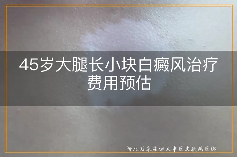 白癜风,治疗费用,病情严重程度,治疗方式,医院选择,地域差异