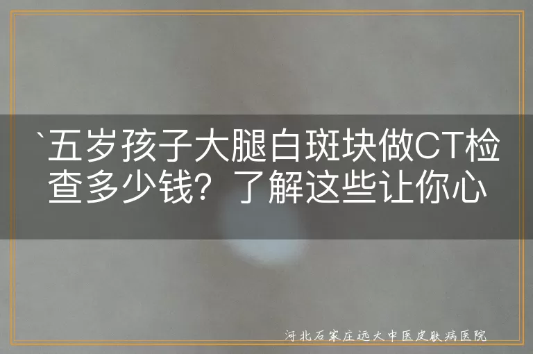 皮肤CT检查,费用,白斑,五岁孩子,医院等级,地区差异,检查仪器先进性,病情复杂