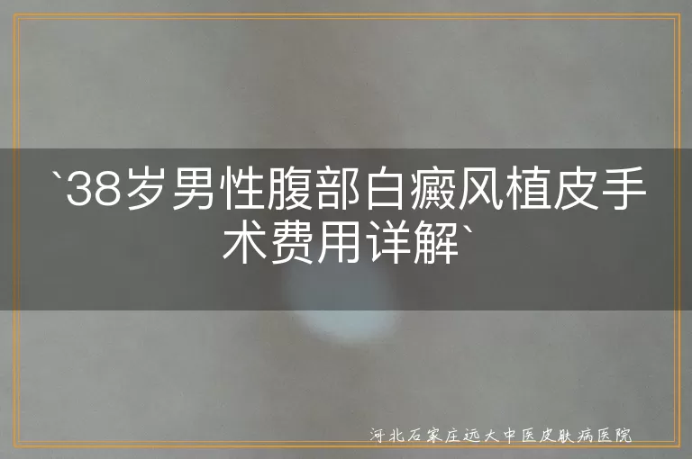 白癜风,植皮手术,费用,植皮面积,医院等级,治疗方案