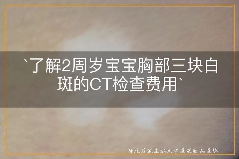 宝宝白斑,皮肤CT检查,费用,诊断,治疗,护理