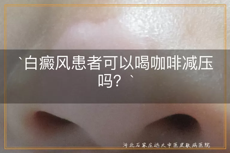 白癜风,咖啡,咖啡因,减压,睡眠质量,免疫功能,色素细胞活性