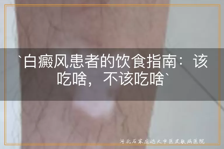 白癜风,饮食调理,抗氧化剂,维生素C,蛋白质,锌和铜,辛辣刺激性食物,高糖高脂肪食物,酒精,饮食均衡