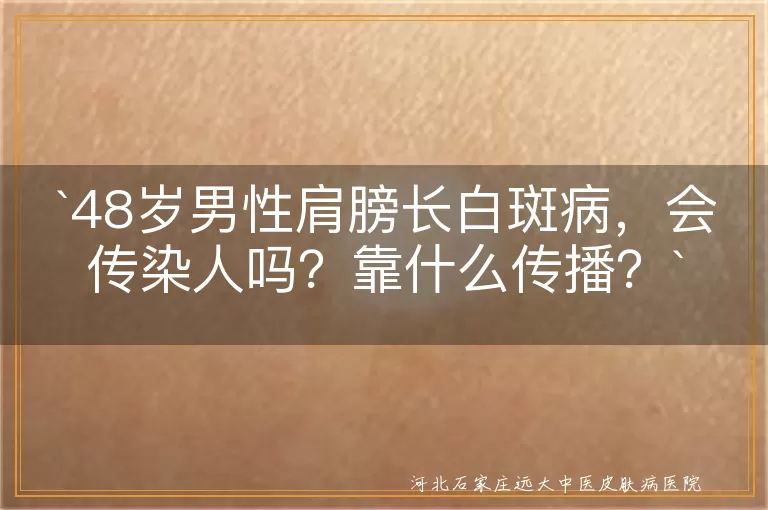 白斑病,白癜风,传染性,遗传因素,自身免疫反应,环境因素,花斑癣（汗斑）,预防,治疗