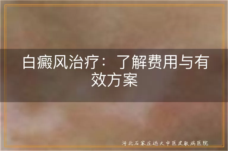 白癜风,治疗费用,药物治疗,光疗,激光治疗,手术治疗,正规医院,日常护理