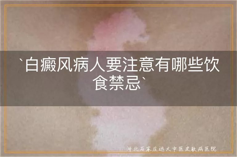 白癜风,饮食禁忌,刺激性食物,维生素C,海鲜,发物,酒精,烟草,微量元素,抗氧化物质,饮食习惯