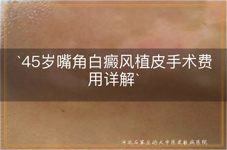 白癜风,植皮手术,费用,医院级别,植皮面积