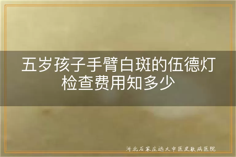 伍德灯检查,白斑,费用,地区差异,医院等级,日常护理