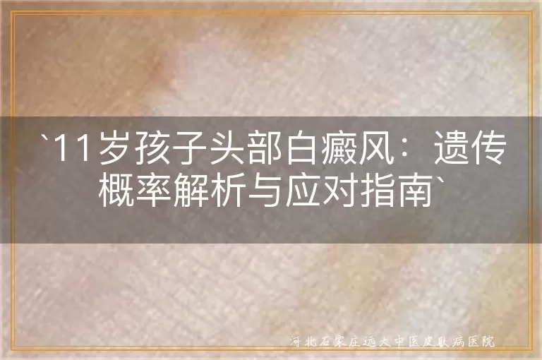 白癜风,遗传性,多基因遗传,自身免疫,环境因素,儿童,心理健康