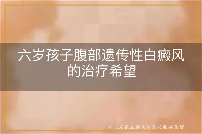 六岁孩子遗传性白癜风,腹部白斑治疗,儿童白癜风康复,遗传性白斑治疗