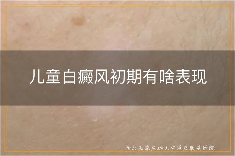 儿童白癜风初期有啥表现