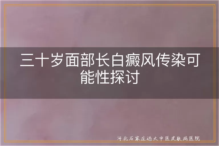 面部白癜风传染性,白癜风成因分析,白癜风治疗方法,白癜风生活注意事项