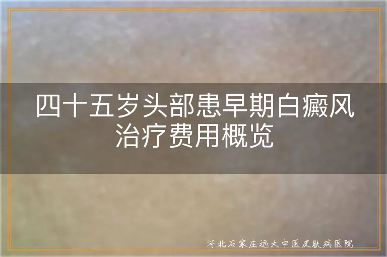四十五岁头部白癜风治疗费用, 早期白癜风治疗费用概览, 白斑治疗费用因素, 白癜风治疗费用详解