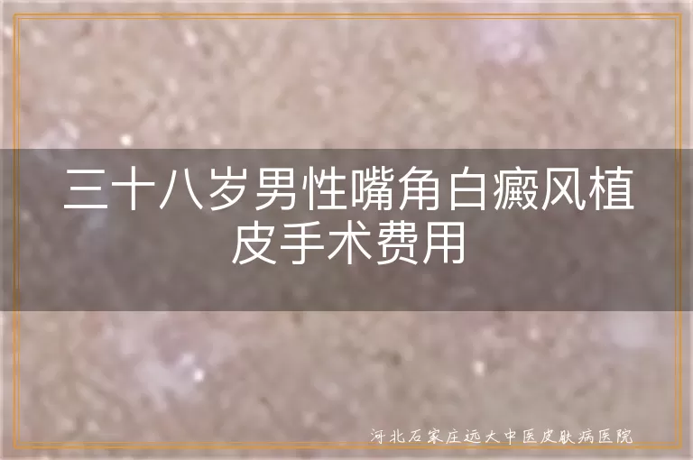 白癜风植皮手术费用, 嘴角白癜风治疗费用, 白斑植皮手术价格, 白癜风手术费用估算