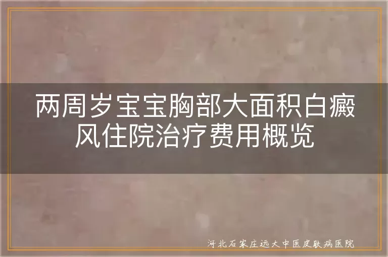 宝宝白癜风治疗费用概览, 白癜风住院治疗花费, 白斑儿童治疗成本, 幼儿白斑病住院费用