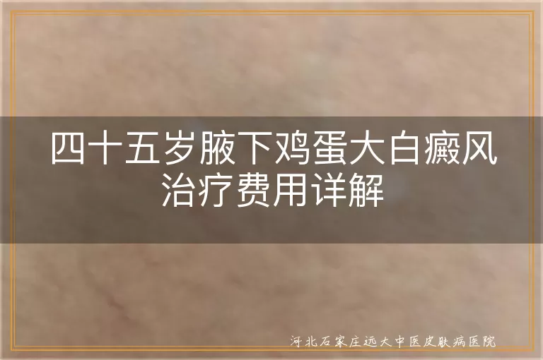 白癜风治疗费用,腋下白斑治疗,白癜风治疗方法,白斑治疗周期