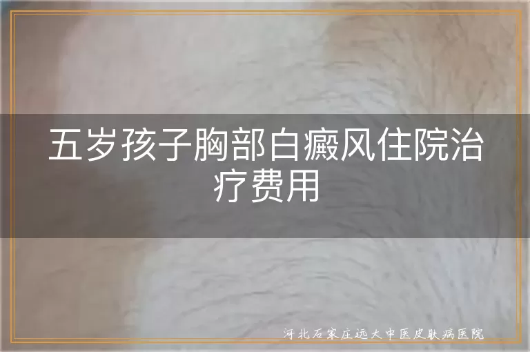 五岁孩子白癜风治疗费用, 胸部白斑住院花费, 儿童白癜风治疗预算, 白斑治疗经济负担