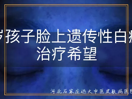 六岁孩子遗传性白癜风治疗, 六岁孩子白斑治疗希望, 遗传性白癜风治疗方法