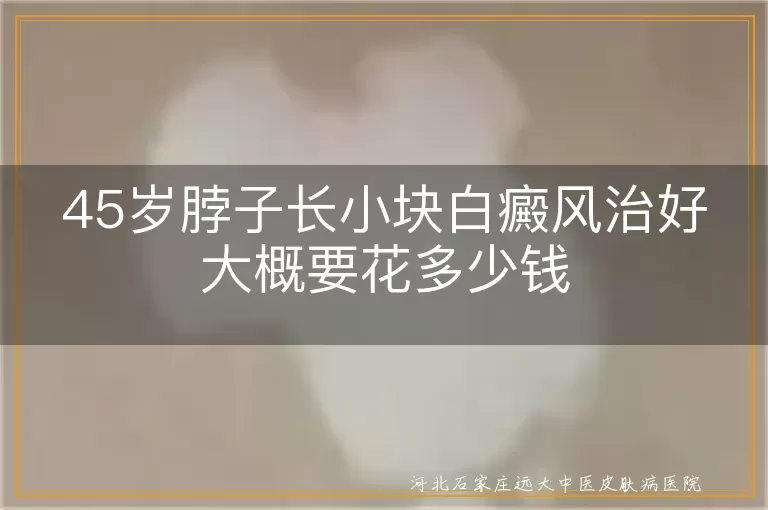 45岁脖子白癜风治疗费用,小块白癜风治疗多少钱,白癜风白斑治疗费用