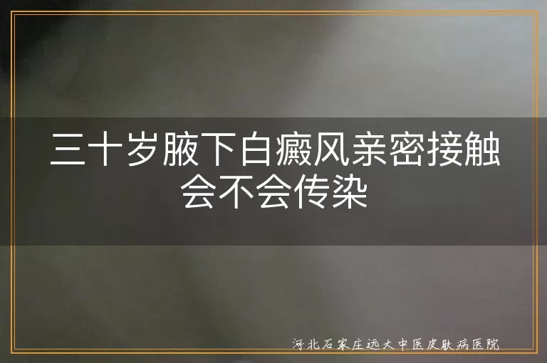 白癜风亲密接触安全性,白癜风非传染性疾病,关爱白癜风患者