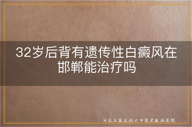 邯郸白癜风治疗方法,遗传性白癜风能治好吗,白斑治疗医院推荐