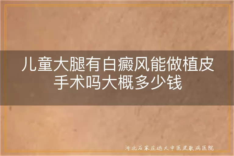 儿童大腿有白癜风能做植皮手术吗大概多少钱