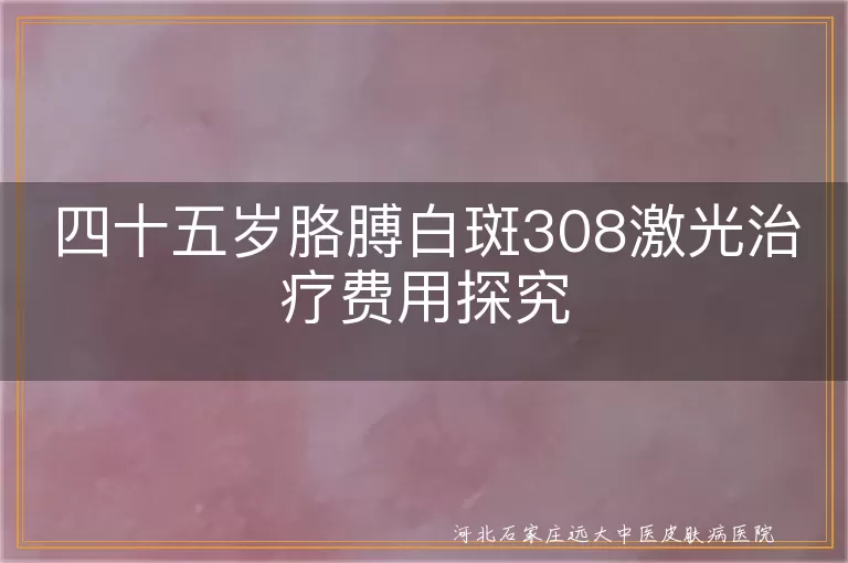 白癜风激光治疗费用,白斑308激光价格,45岁白斑治疗成本