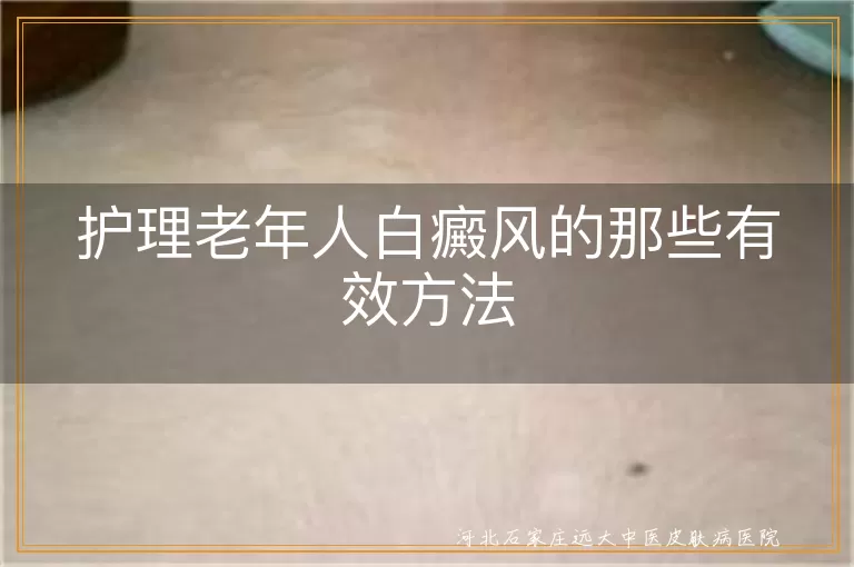 老年人白癜风护理方法,白癜风饮食与防晒,白斑定期检查与运动