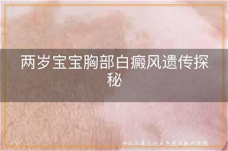 白癜风遗传方式解析,宝宝白斑遗传原因探讨,儿童白癜风遗传风险揭秘