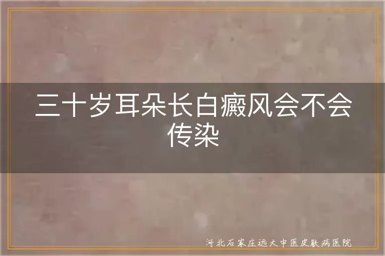 白癜风传染性,耳朵白癜风治疗,白癜风日常护理