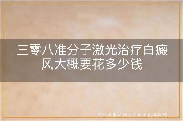 三零八准分子激光治疗白癜风大概要花多少钱