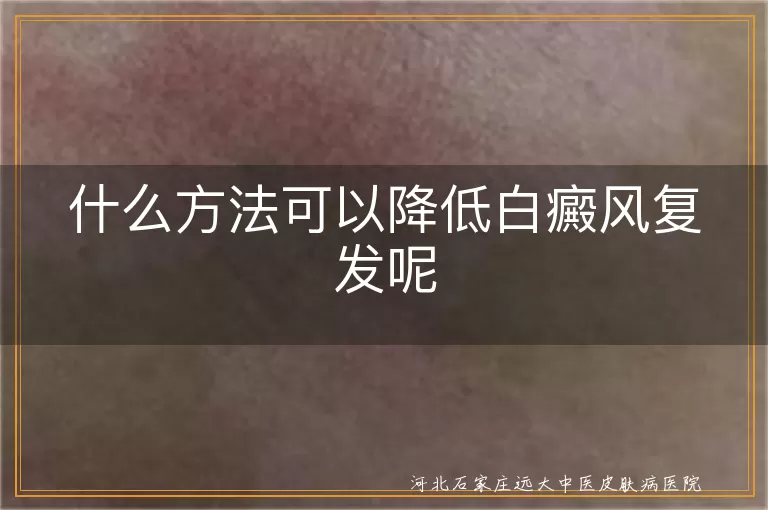 预防白癜风复发措施,白斑疾病防复发方法,白癜风复发风险降低策略