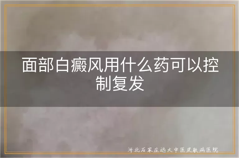 面部白癜风药物治疗方案,白癜风复发预防用药,白斑复发控制药物选择