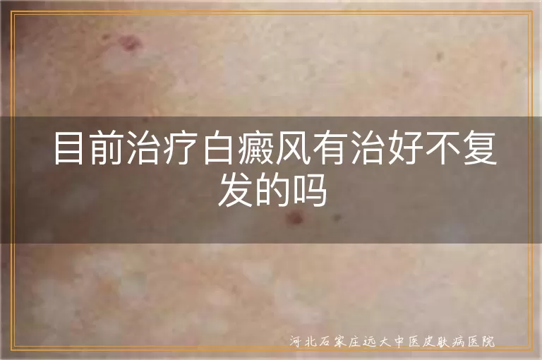 白癜风根治不反弹真的难吗,白斑治疗不见复发实例,白癜风五年不复发可行法