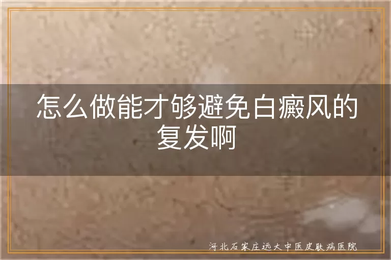 怎么做能才够避免白癜风的复发啊