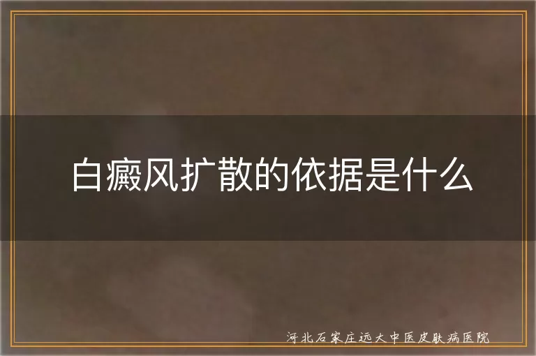 白癜风扩散的依据是什么